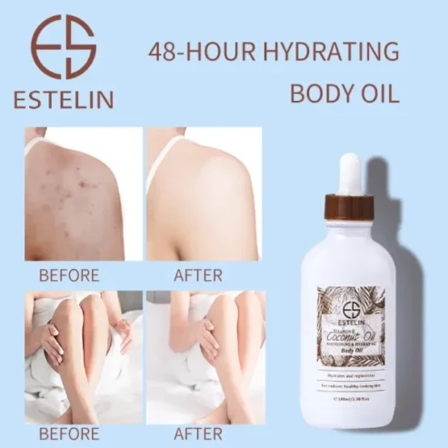 Estelin Coconut Oil & Vitamin E Nourishing & Hydrating Body Oil – 100ml