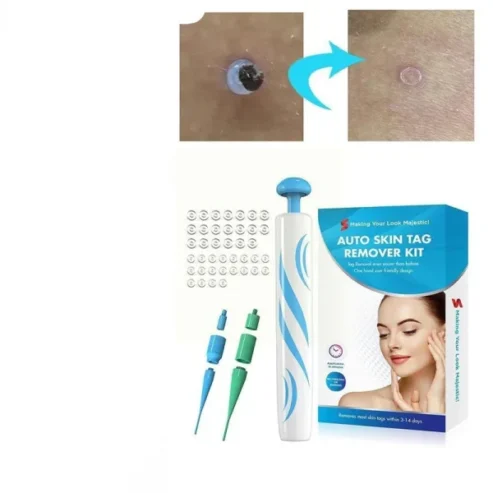 Auto Skin Tag Remover Painless | Skin Tag Removal Kit Adult Mole Wart Remover