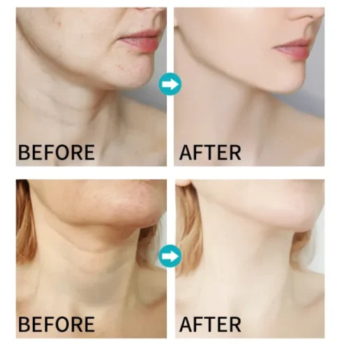 Dr. Rashel Vitamin C Ultra-smoothing Neck Cream 120g